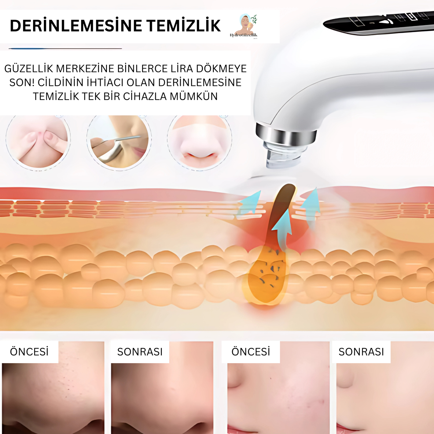 Cildiniz İçin Profesyonel Bakım: HydroGüzellik™ ile Doğal Güzellik
